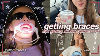 getting bottom braces vlog 🫶✨️ amp taking off herbst appliance [upl. by Nosa622]