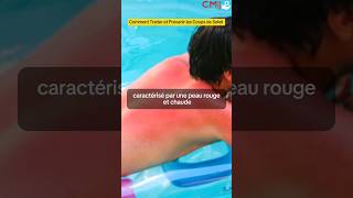 Soins et Cicatrisation des Coups de Soleil  Guide Complet par des Experts [upl. by Elmo]