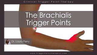 The Brachialis Trigger Points [upl. by Edina]