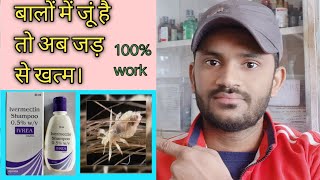 Ivrea shampu use benefits side effects full review in hindiपुरी जानकारी हिन्दी भाषा में [upl. by Bokaj]