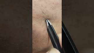 Tweezing Stubborn Facial Hairs Extraction Tweezers [upl. by Notslah]