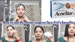 How to use Acnestar soap on faceAcnestar benefitsPimple amp acne treatmentAcneprone skin skincare [upl. by Tnert665]