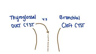 Thyroglossal duct cyst vs branchial cleft cyst remnants mnemonic  USMLE [upl. by Minni]