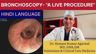 BRONCHOSCOPY quotA Live Procedurequot HINDI Basic A to Z about FOB Anatomy of Bronchi Dr Hemant K A [upl. by Anpas]