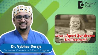 Head Shape amp Treatment of APERT SYNDROME BABY newborn  Dr Vybhav Deraje Doctors Circle [upl. by Kovacs]