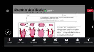 paraganglioma management [upl. by Sixel]