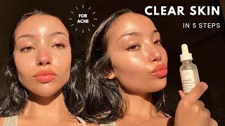 MY UPDATED SKINCARE ROUTINE  unsponsored skincare for acne [upl. by Matthieu]