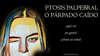 Ptosis Palpebral o Párpado Caído [upl. by Rolyak]