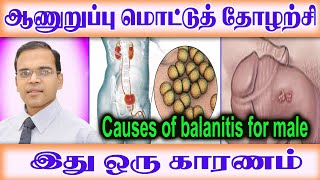 ஆணுறுப்பு தோல் புன் அலர்ஜி ஏன் ஏற்படுகிறது அதன் காரணங்கள் Why does genital ulcer herpes occur [upl. by Willcox]