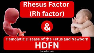 Rhesus Disease and HDFN [upl. by Chenay]