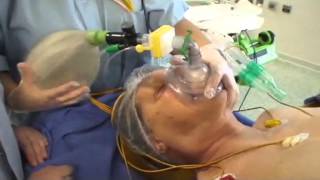 Intubation orotrachéale IOT  bases anatomiques et technique de réalisation [upl. by Adieren]