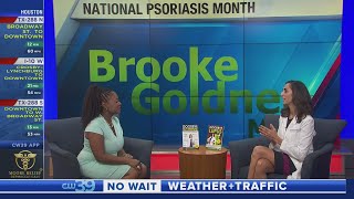 Psoriasis Awareness Month and Dr Brooke Goldner talks with CW39 Sharron Melton about how to Manage [upl. by Yerok472]