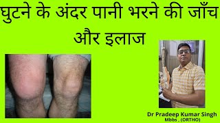 घुटने के अंदर पानी भरने की जाँच और इलाजKnee Effusion Test and TreatmentDr Pradeep Kumar Singh [upl. by Egdirdle]