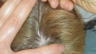 Read description no talking 1st 8 min ASMR dandruff rat tail amp lice combs scalp scratching picking [upl. by Tengdin477]