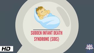 Sudden Infant Death syndrome Causes and Prevention [upl. by Yrrak819]