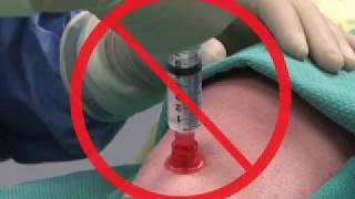 Insertion of an Intraosseous Needle in Adults [upl. by Ecirpac]