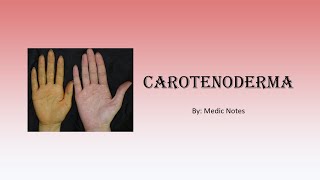 Carotenoderma  orange skin causes and pathophysiology [upl. by Ttegdirb]