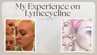 LYMECYCLINE EXPERIENCE [upl. by Cir]