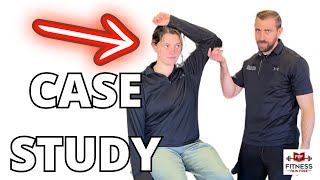 How I Diagnose and Treat Cervical Radiculopathy CASE STUDY Physical Therapy [upl. by Aiekal900]