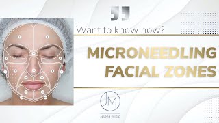 Microneedling technique step by step [upl. by Gavan]