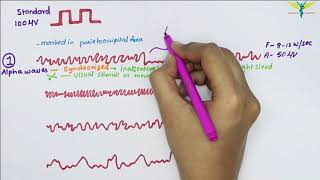 Electroencephalogram EEG  Waves  Physiology [upl. by Odrude]