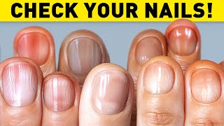 Things Your Nails Can Tell About You [upl. by Neerual159]