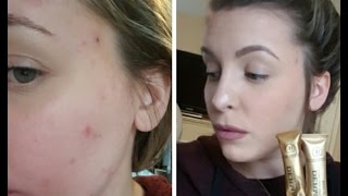 Dermacol Foundation Review  Oily Acne Prone Skin [upl. by Lynne203]