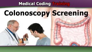 Coding for Screening Colonoscopies — CPT Coding Guidelines [upl. by Anazraf281]