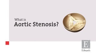 What is Aortic Stenosis [upl. by Nnahsal]