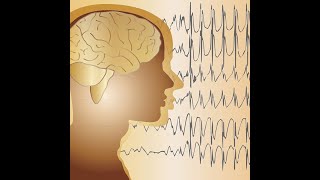 Rapid summary of Epilepsy with pregnancy amp Obstetric cholestasis [upl. by Nehgem]