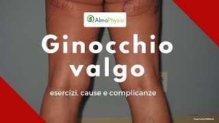 ginocchio valgo esercizi cause e complicanze SPIEGAZIONE COMPLETA [upl. by Enirok]