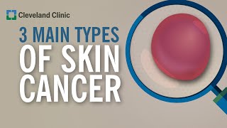 3 Types of Skin Cancer [upl. by Meredeth]