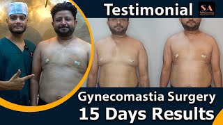 15 Days Post Gynecomastia Surgery [upl. by Crabb42]