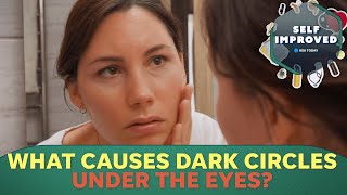 A Dermatologist reveals why you get dark circles under your eyes  SELF IMPROVED [upl. by Lebatsirc]