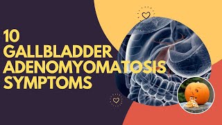 10 Gallbladder Adenomyomatosis Symptoms [upl. by Jillayne]