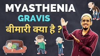 Myasthenia gravis बीमारी क्या है   myasthenia gravis in hindi  myasthenia gravis treatment [upl. by Boleslaw149]