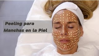 Peeling para Manchas en la Piel [upl. by Bonns]