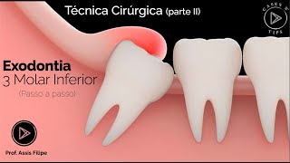 Exodontia terceiro molar inferior passo a passo clinico [upl. by Enirrok]