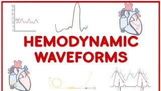 Hemodynamic Waveforms Made Simple [upl. by Leisam]