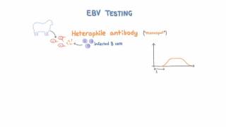 Epstein Barr Virus EBV Diagnosis and Testing [upl. by Klina530]