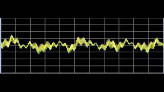 AntiAging 2 Skin Repair  Rife Frequencies [upl. by Enaamuj483]