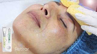 Dermaheal Stem Crums microneedling Paso a paso [upl. by O'Gowan]