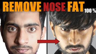 Mote Naak Ko Patla Karne Ka Tarika हिंदी How To REMOVE Nose Fat  100 Slim  Sharp Big Nose [upl. by Hare]