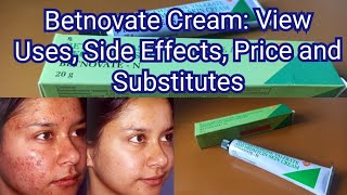 Betnovate Cream  Review Uses and Side EffectsPriceSubstitutes Availability in Tamil  How to Use [upl. by Xena]