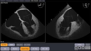 VIST® One TEE  the most sophisticated realtime ultrasound simulation [upl. by Eussoj270]