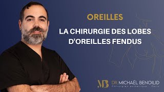 Chirurgie des lobes doreilles fendus [upl. by Ogilvy]