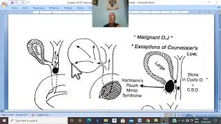 Biliary disorders in Arabic 13  Obstructive jaundice  part 1   by Dr Wahdan [upl. by Naul70]