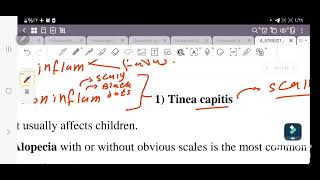 Dermatology  fungal infection  شرح العدوى الفطريه جزء من كورس الجلديه [upl. by Theressa]