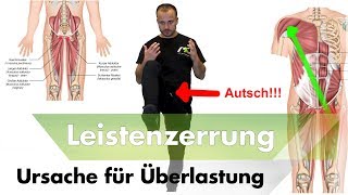 Leisten amp Adduktorenzerrungen  1 Der Hauptursachen [upl. by Naux]