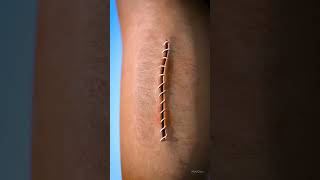 Wound healing process 3D video Shorts shorts shortsfeed funny [upl. by Eusassilem117]